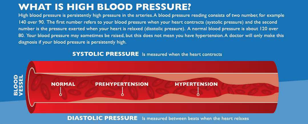 Common Comorbidities Covid-19 what is high blood pressure